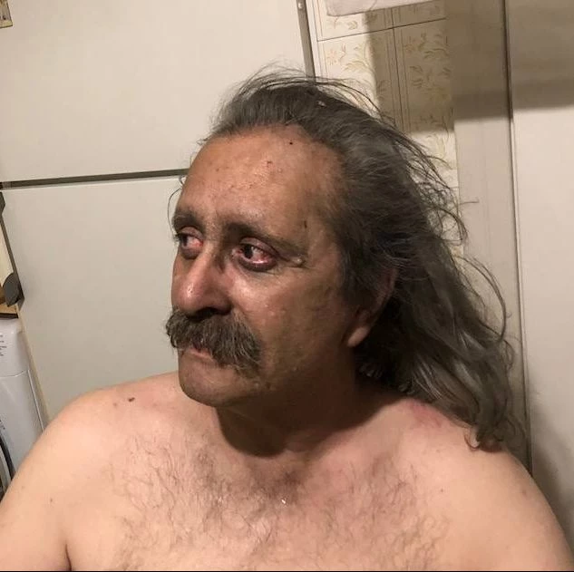 Η συγκλονιστική ανάρτηση επιζήσαντα από τον πύρινο εφιάλτη στο Μάτι – Σε ποιους τα χώνει άγρια!